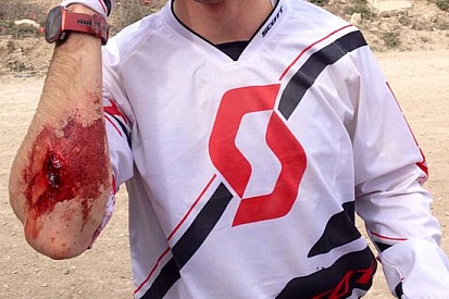 Terol cade facendo motocross: 6 punti al braccio