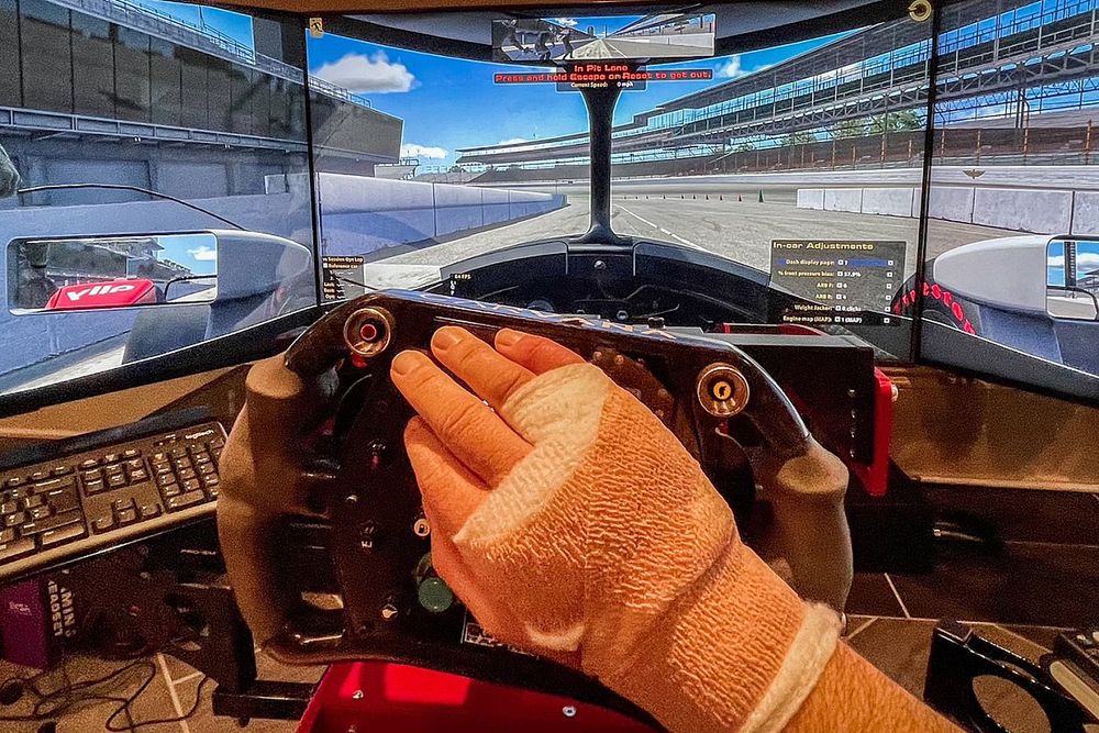 La mano vendada de Jimmie Johnson tras la operación.