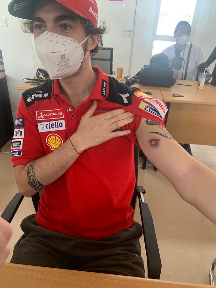 Francesco Bagnaia, Ducati Team, con una herida en el brazo por una piedra